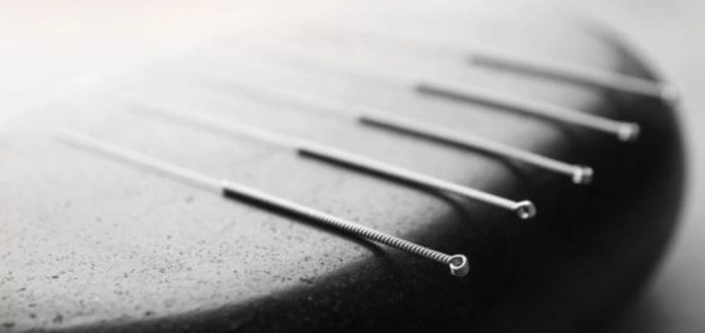 Tratamiento de acupuntura para el equilibrio digestivo en Barcelona Saam Acupuntura