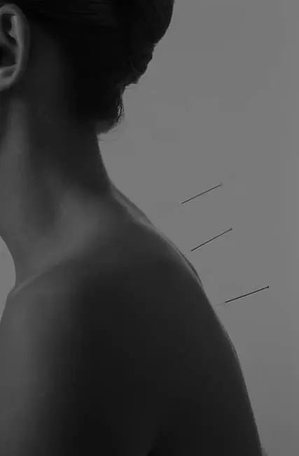 Saam Acupuntura Salud Integral